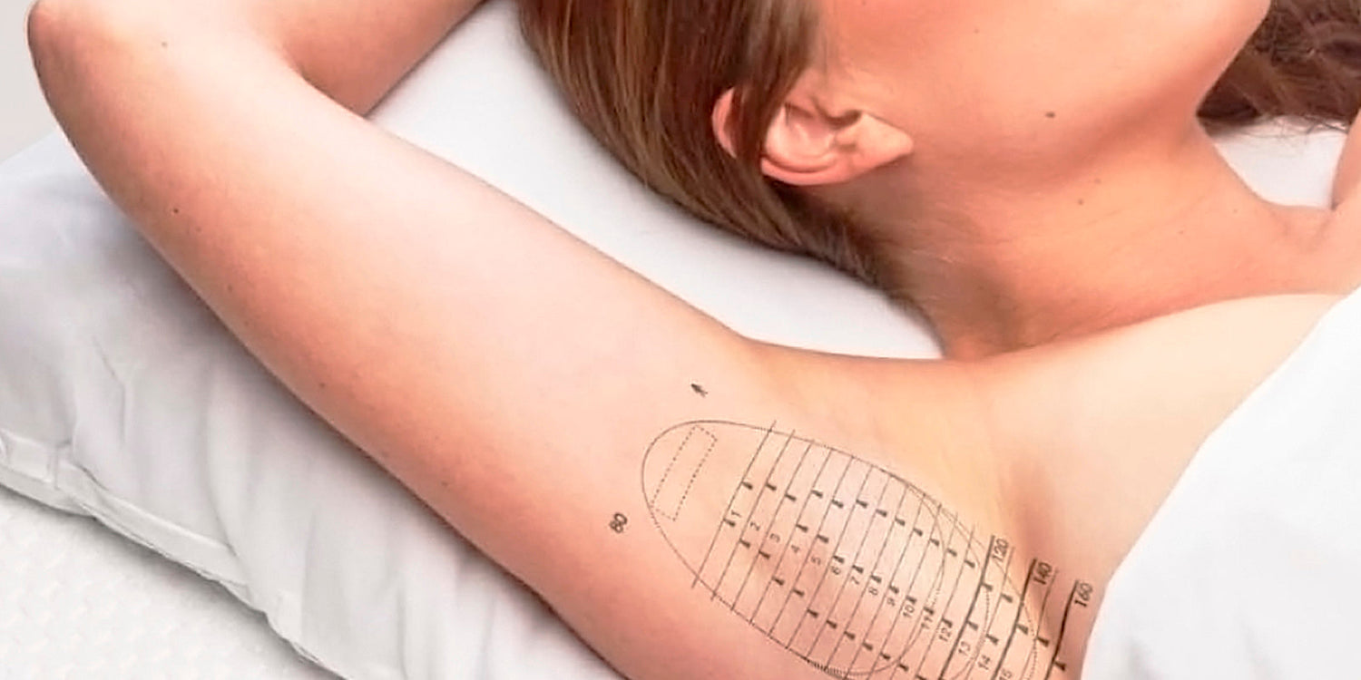 miraDry עדויות