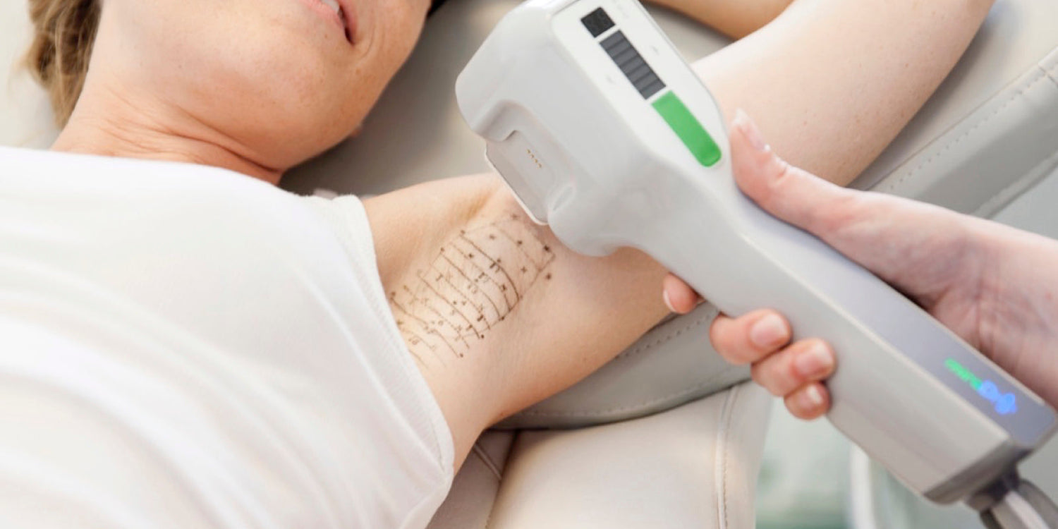 יתרונות טכנולוגיית מירה דריי