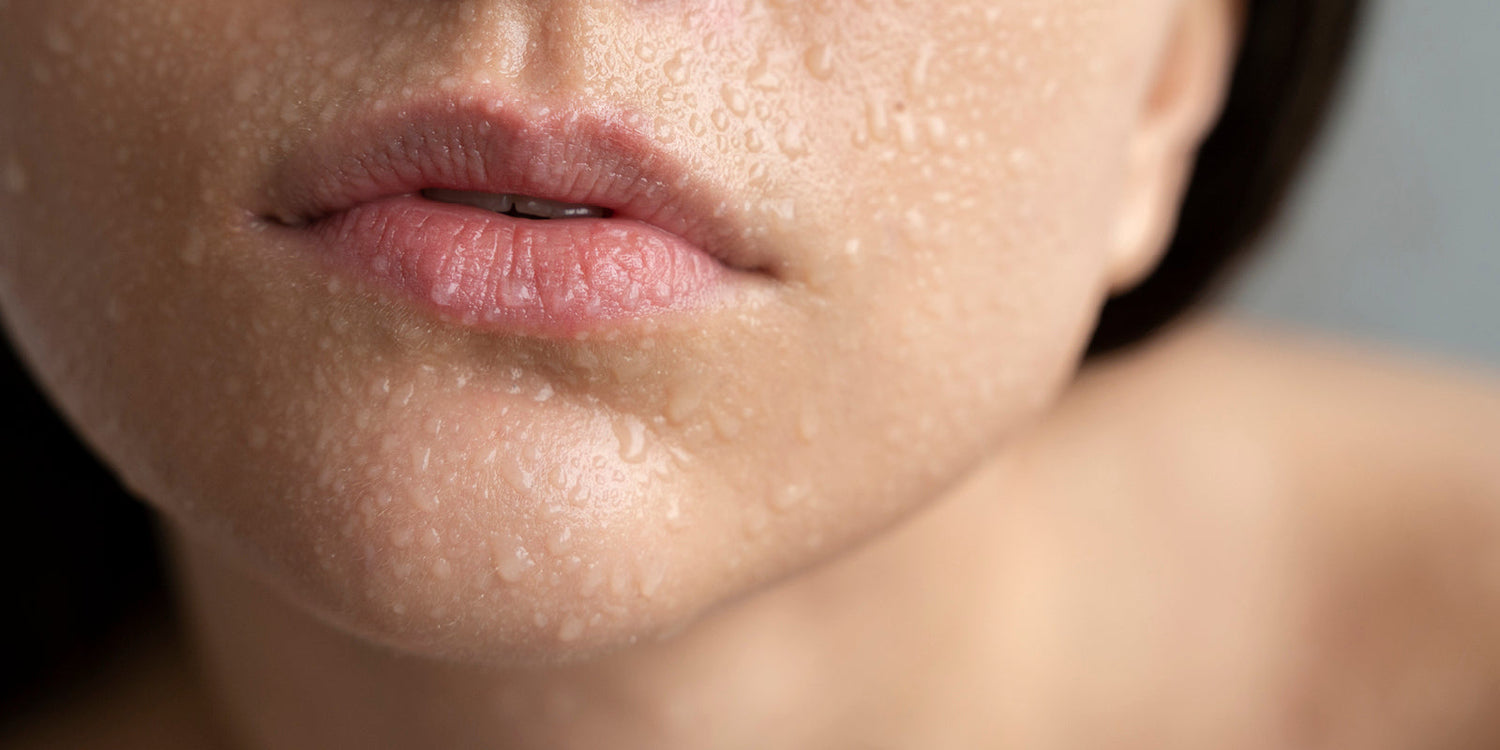 הזעה מוגברת בפנים